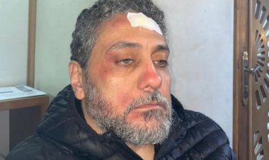 وحدة إضاءة وقعت على دماغه.. تامر فرج يتعرض  لإصابة عمل أثناء التصوير 