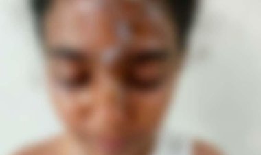 تشوه جسد طالبة في ظروف غامضة داخل مدرسة بمنطقة فيصل.. صور