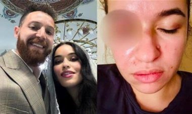 رنا طارق ترد على اتهامات محمود حجازي: مش بسكت على الظلم ومعايا كل الأدلة