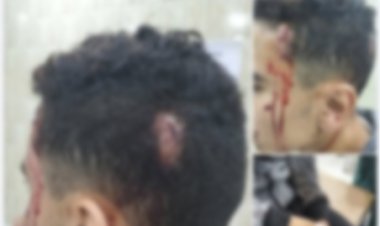 الشرقية: ضبط شاب تعدى على صديقه بمفتاح فك إطارات سيارات