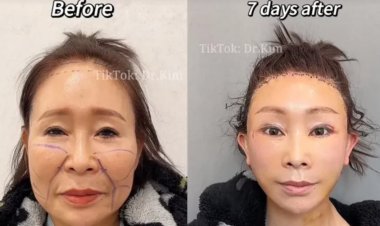 فيديوهات دكتور تجميل تثير الجدل بسبب بشاعتها!