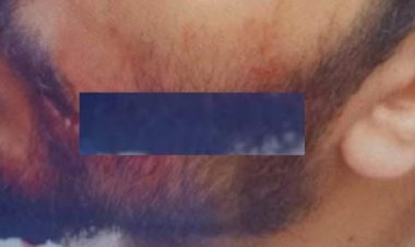 قطع وشه.. تفاصيل الاعتداء على طبيب مستشفى سيد جلال ونقابة الأطباء تطالب بتوقيع عقوبات رادعة