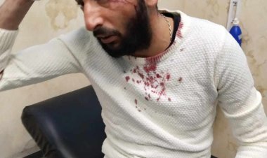 سائق ميكروباص يمزق جسد مواطن أمام زوجته وابنه في التجمع الخامس (صور)