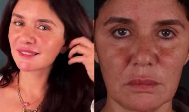 غادة عادل تستعيد شبابها بعملية شد الوجه : رجعت 15 سنة ورا