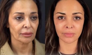 داليا البحيري تتصدر التريند بعد عملية تجميل:  حاسة إني لسة صغيرة