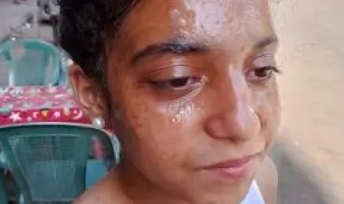 السجن 6 أشهر لموظفة فى واقعة حرق الطالبة كارولين مرقس داخل مدرسة خاصة بالعمرانية