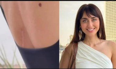 كنت ببكي ومحدش عارف.. فايا يونان تكشف أصعب لحظات إصابتها بورم خبيث