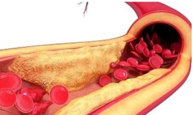 أطعمة تساعد في تعزيز صحة الدماغ.. حافظ على صحتك وتعرف عليها