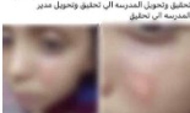 القبض على مدرسة حرقت وجه  طالب بالولاعة ومنعته من دخول الحمام بسوهاج