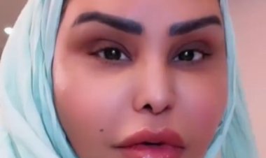 أول ظهور للمطربة الإماراتية أحلام  بعد نجاح عملية شد الوجه