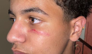 بالصور.. مدرس يتعدى على طالب بالضرب.. ووالد الطالب يحرر محضرا 