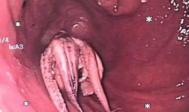 أخطبوط كامل في فم رجل.. ما القصة؟