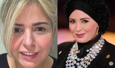 صابرين تكشف معاناتها خلال فترة ارتداء الباروكة: كنت تايهة ومنكمشة وخايفة من كلام الناس