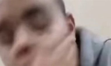 "الجواز مش بالعافية".. طبيب الأسنان المصفوع يكشف تفاصيل تعرضه  للاعتداء على يد فتاة