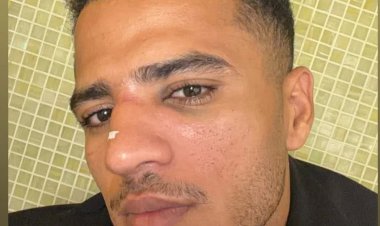 أحمد ربيع يعلن إصابته بكسر في الأنف بعد مباراة الزمالك والجيش الرواندي