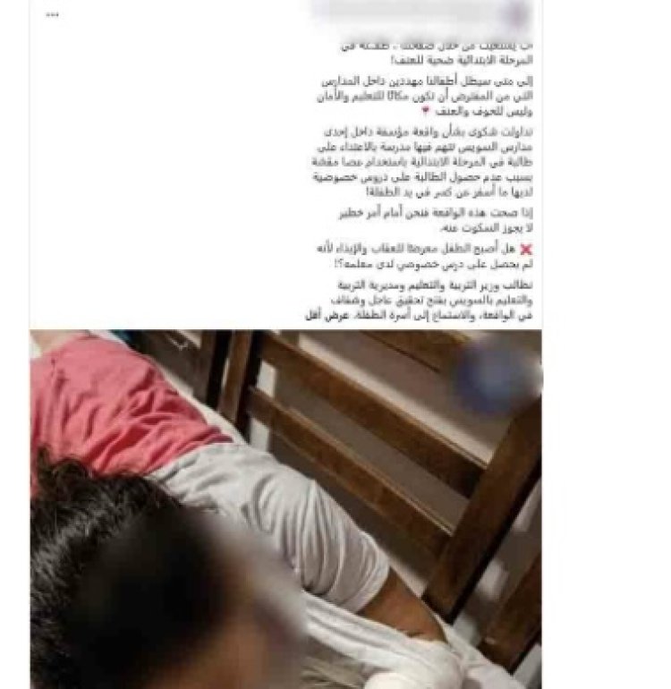 الداخلية تكشف ملابسات تعدي مدرسة على طالبة وإصابتها بشرخ في اليد بالسويس