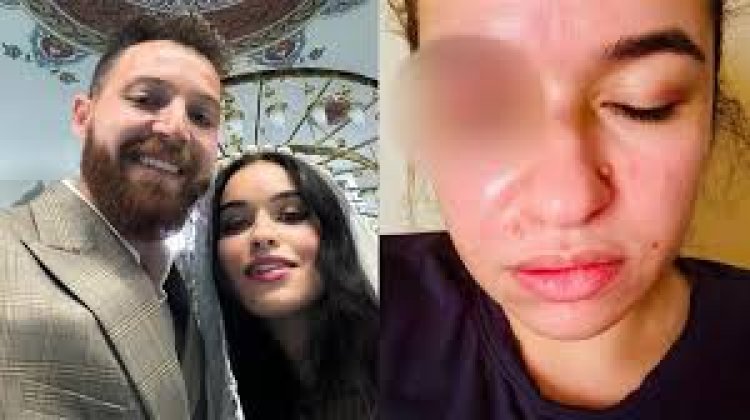 "بعد وصول الخلافات للقضاء".. طلب بحظر النشر في قضية الفنان محمود حجازي مع زوجته