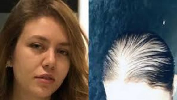 بعد تعرضها للصلع.. رحمة حسن تكشف عن تطورات حالتها الصحية