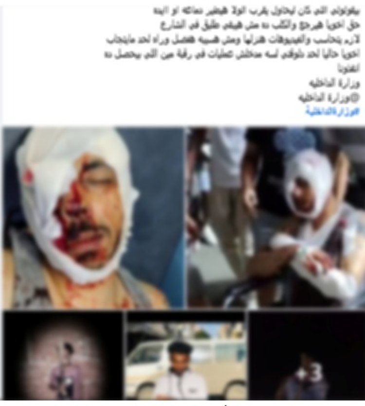الأمن يكشف ملابسات تمزيق جسد مسجل خطر على يد آخر في الإسكندرية