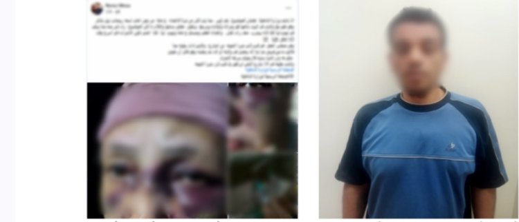 القبض على مسجل خطر لتعديه بالضرب على حماته وإصابتها في القليوبية