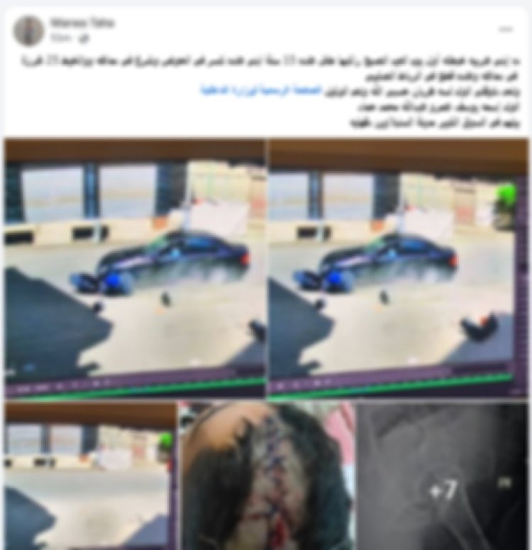 الأمن يكشف ملابسات فيديو حادث الدقهلية.. وضبط قائد السيارة المتسبب في إصابة طالب وفراره