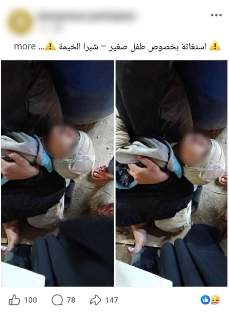 ضبط سيدة استغلت حفيدها المصاب ظاهريًا في التسول بشبرا الخيمة