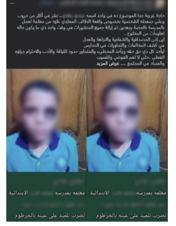 كشف حقيقة منشور عن تعدي معلمة على طالب بالإسماعيلية.. خبط في دكة خشبية وادعى أن معلمته ضربته خوفاً من أمه