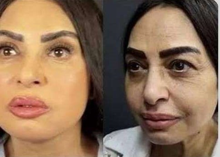 سلوى خطاب تكشف أسباب خضوعها لشد الوجه العميق: «كنت بخاف»