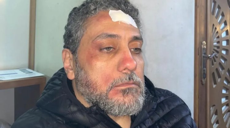 وحدة إضاءة وقعت على دماغه.. تامر فرج يتعرض لإصابة عمل أثناء التصوير