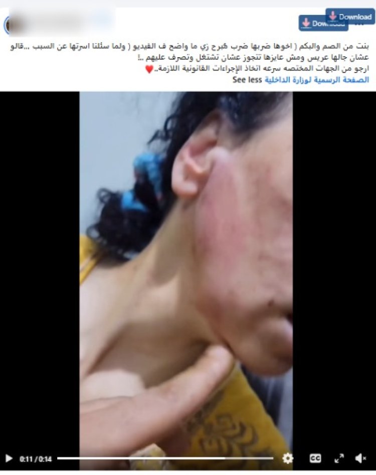 بسبب رفضهما زواجها.. ضبط شقيق ووالد فتاة من ذوي الهمم بعد الاعتداء عليها بالغربية