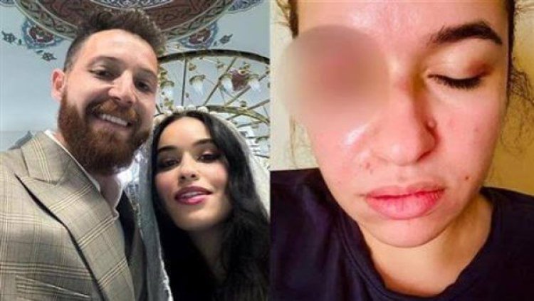 رنا طارق ترد على اتهامات محمود حجازي: مش بسكت على الظلم ومعايا كل الأدلة