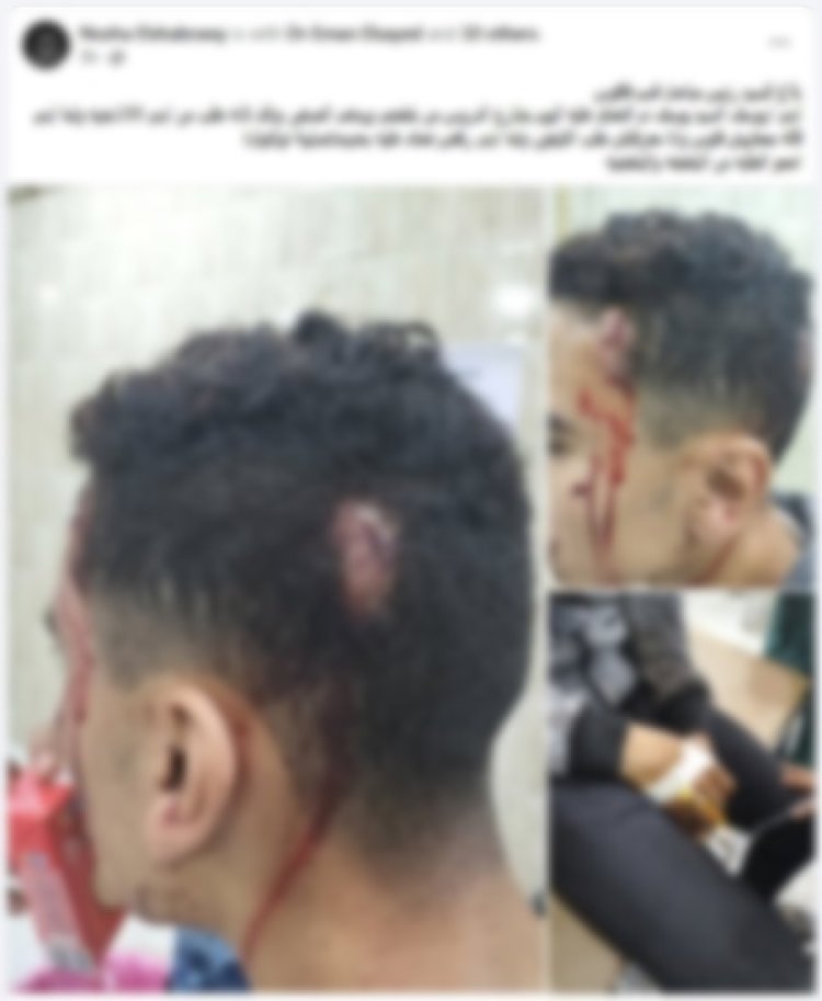 الشرقية: ضبط شاب تعدى على صديقه بمفتاح فك إطارات سيارات