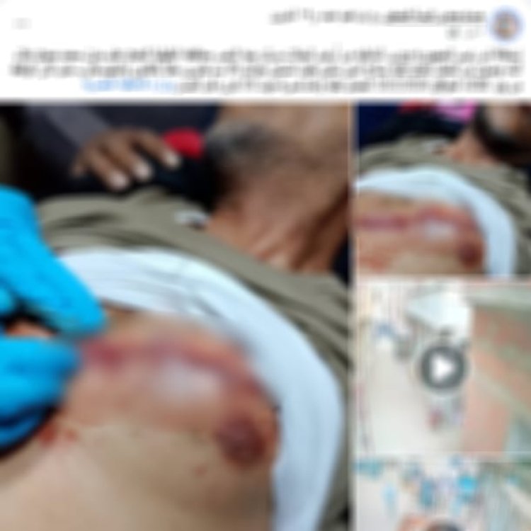 بسبب لهو الأطفال.. ضبط عامل تعدى بسلاح أبيض على آخر وأصابه بجرح قطعي في الدقهلية