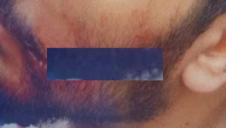 قطع وشه.. تفاصيل الاعتداء على طبيب مستشفى سيد جلال ونقابة الأطباء تطالب بتوقيع عقوبات رادعة