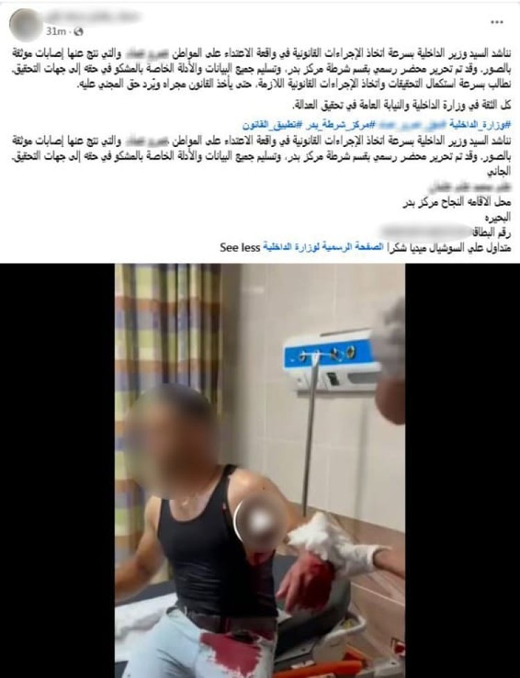 ضبط تاجر أسماك لاتهامه بالاعتداء على عامل بسلاح أبيض في البحيرة