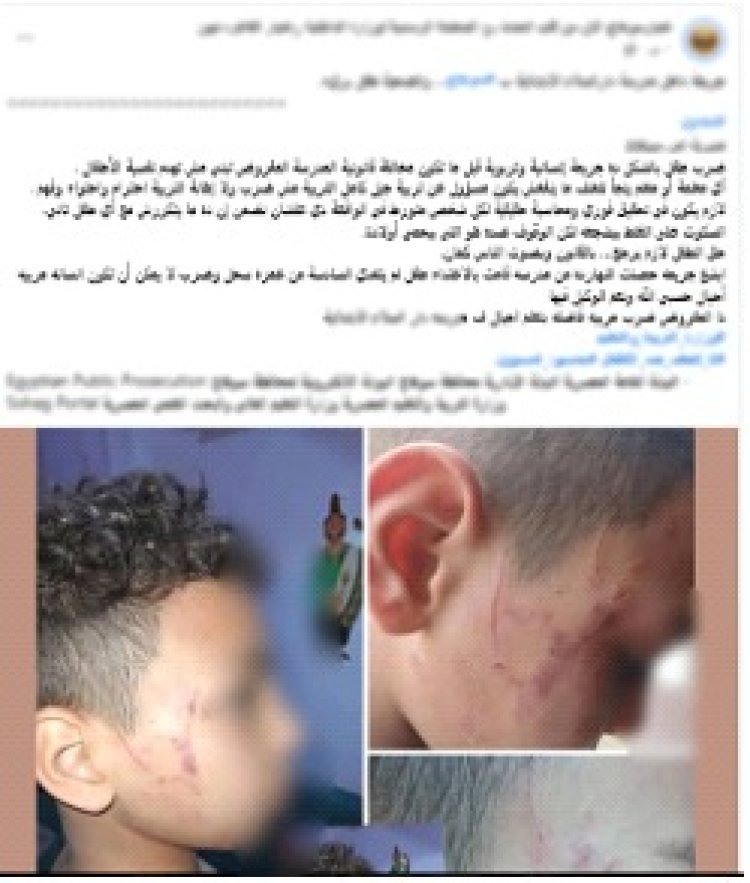 القبض على معلمة لتعديها بالضرب على طالب والتسبب فى إصابته فى وجهه  بسوهاج 