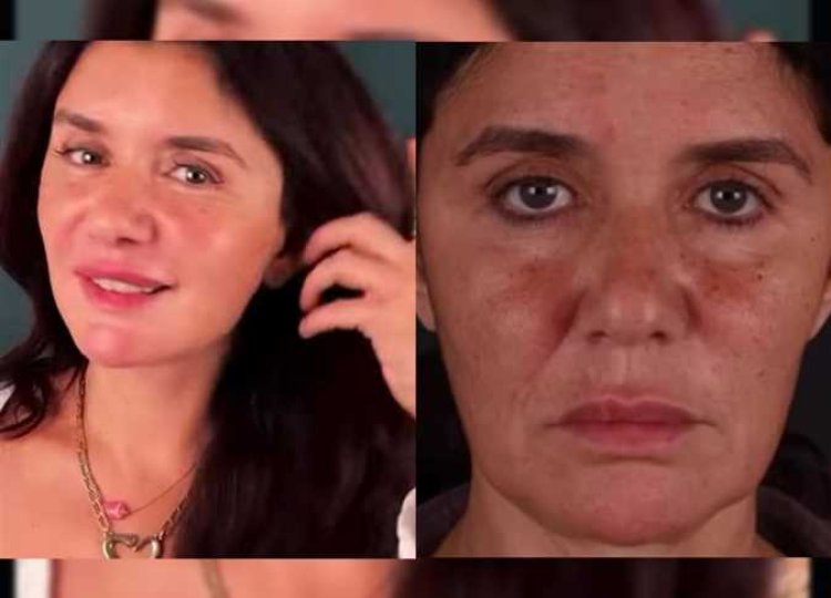 غادة عادل تستعيد شبابها بعملية شد الوجه : رجعت 15 سنة ورا
