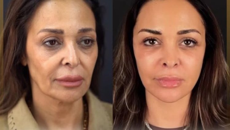 داليا البحيري تتصدر التريند بعد عملية تجميل:  حاسة إني لسة صغيرة