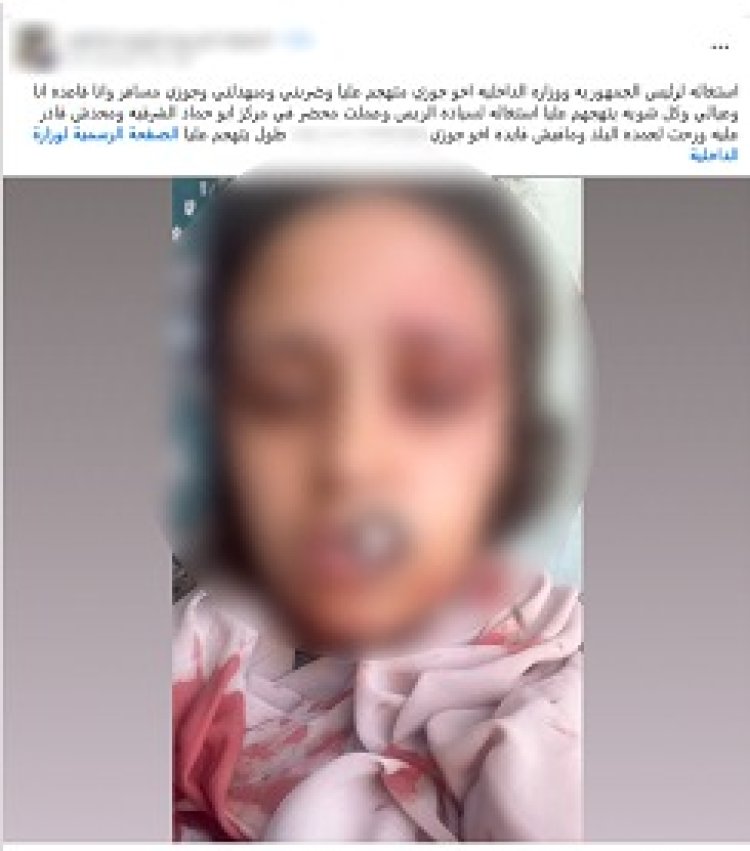 كشف ملابسات فيديو تعدي شقيق زوج على ربة منزل بالشرقية.. وضبط المتهم