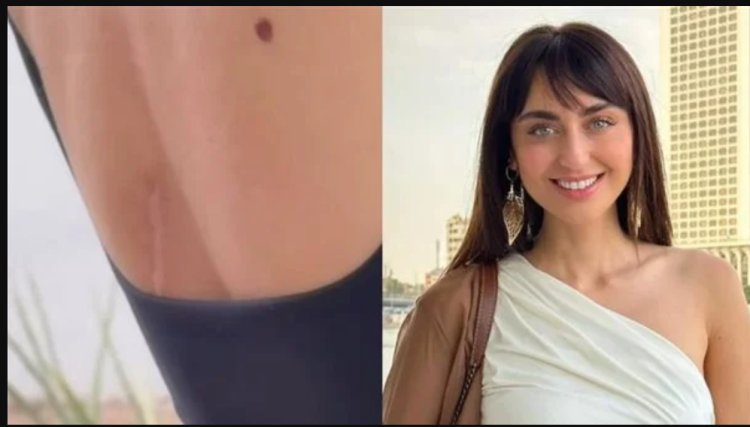 كنت ببكي ومحدش عارف.. فايا يونان تكشف أصعب لحظات إصابتها بورم خبيث