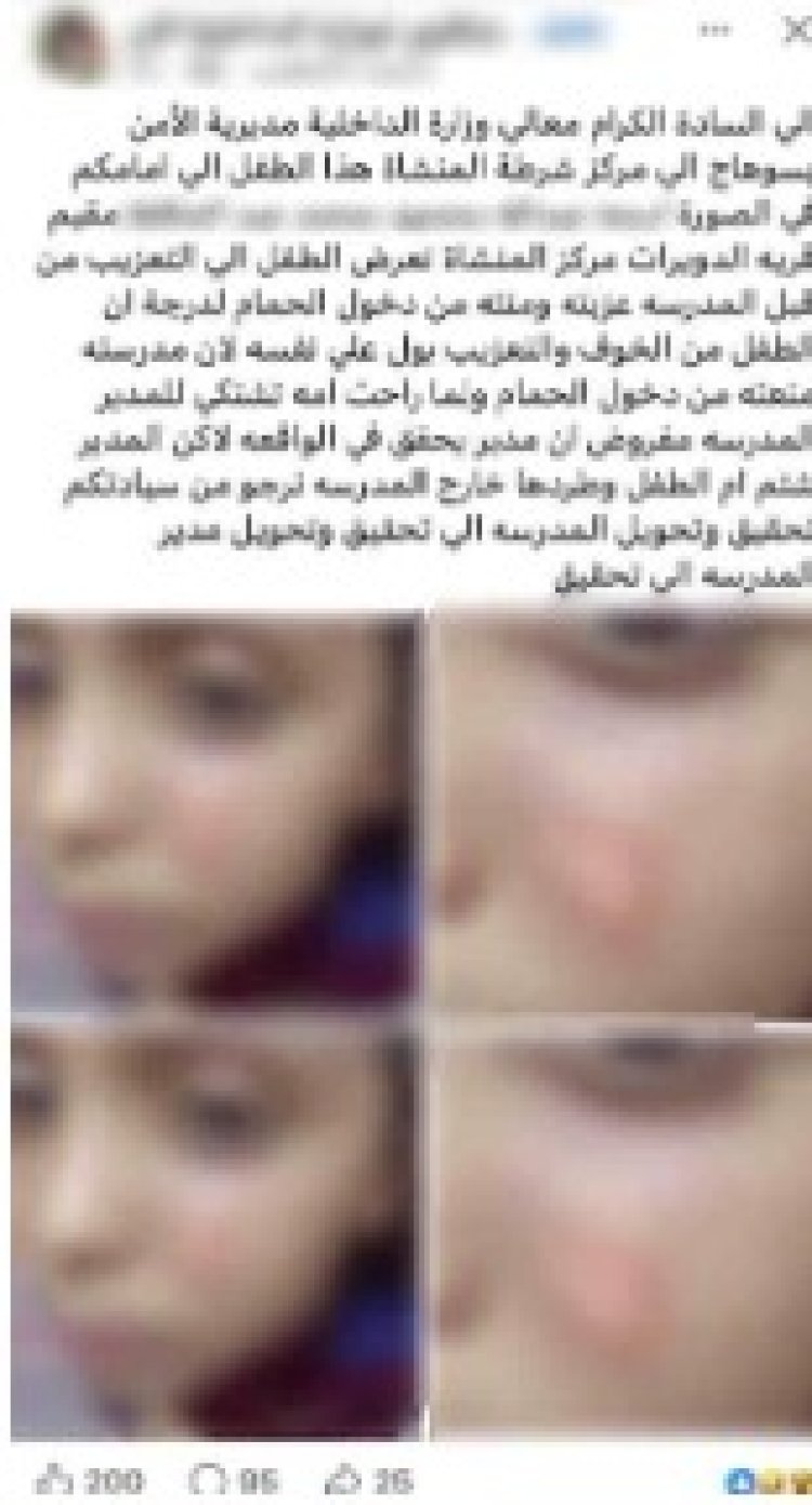 القبض على مدرسة حرقت وجه  طالب بالولاعة ومنعته من دخول الحمام بسوهاج