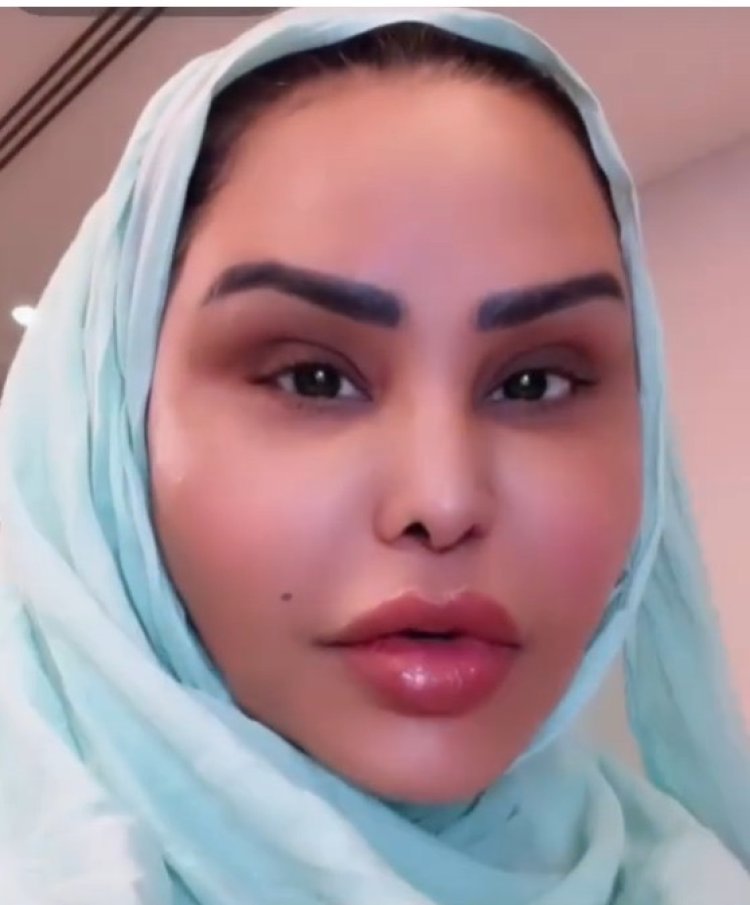 أول ظهور للمطربة الإماراتية أحلام  بعد نجاح عملية شد الوجه