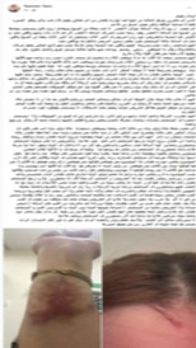 ضبط 3 سيدات اعتدين على ممرضتين داخل مستشفى ببورسعيد