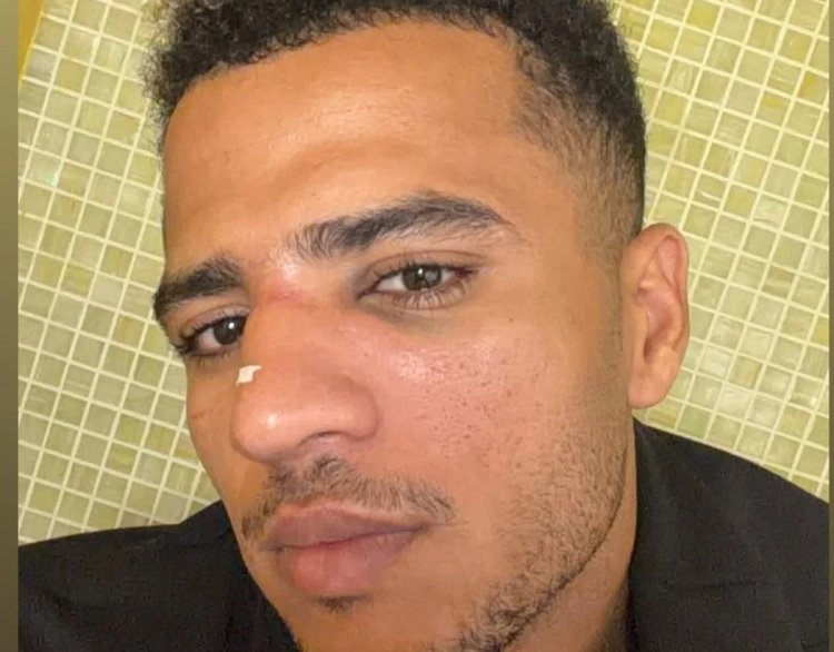 أحمد ربيع يعلن إصابته بكسر في الأنف بعد مباراة الزمالك والجيش الرواندي