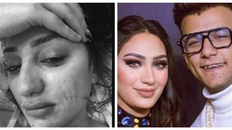 صورة صادمة لجهاد أحمد تثير الجدل حول أسباب طلاقها من عصام صاصا